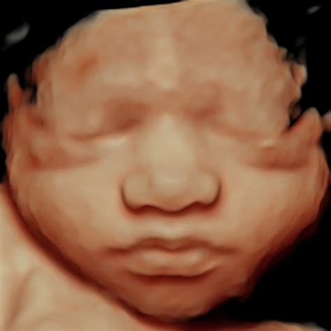 heavenly 3d ultrasound|heavenly 3d 4d ultrasound whittier.